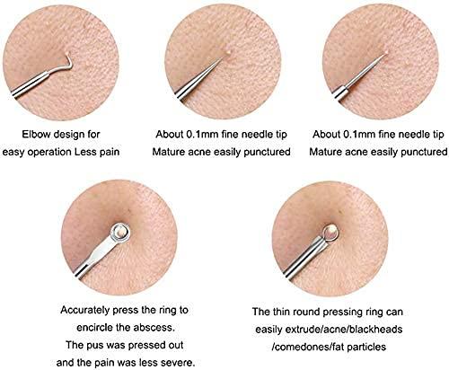 White Stainless Steel Blackhead Remover Needle