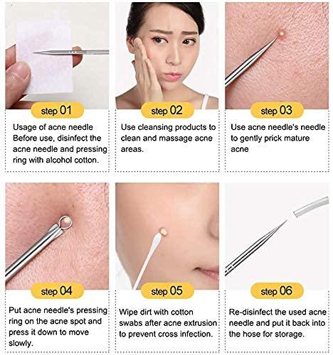 White Stainless Steel Blackhead Remover Needle
